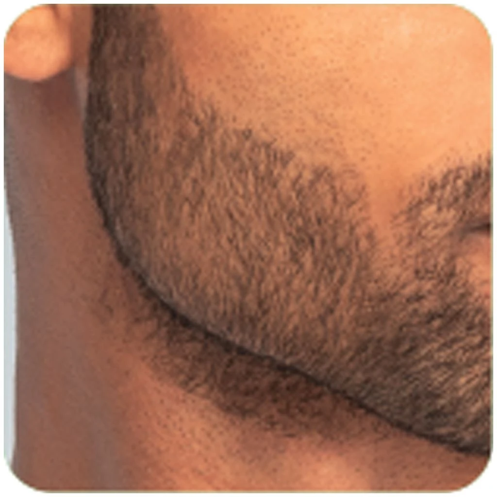 Remington T-Series Ultimate Precision Tondeuse Ă Barbe MB7000 â Image 11